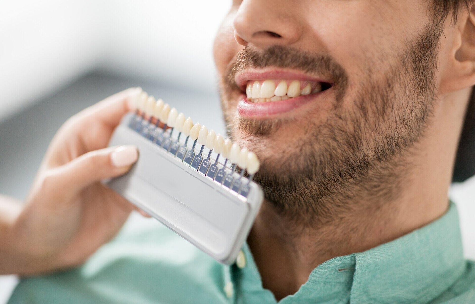 A man is holding a tooth color chart in front of his mouth.