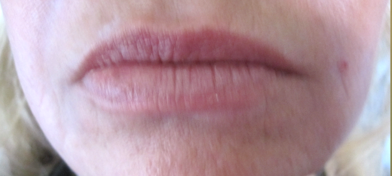 Placerville Permanent Makeup lips before