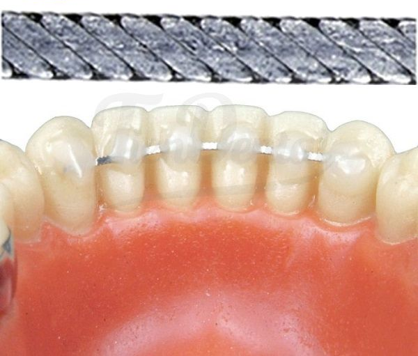 ALAMBRE TRENZADO PLANO PARA CONTENCIÓN LINGUAL