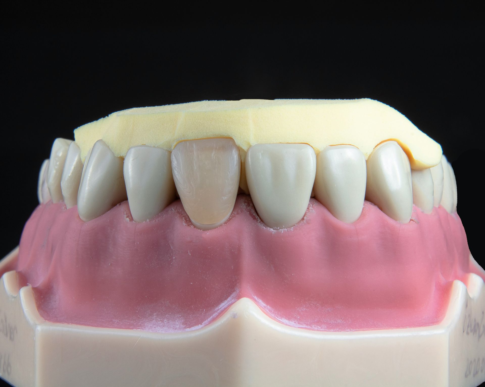 Modelo dental con dientes y componente tipo retenedor de color amarillo; encías rosadas y fondo negro.