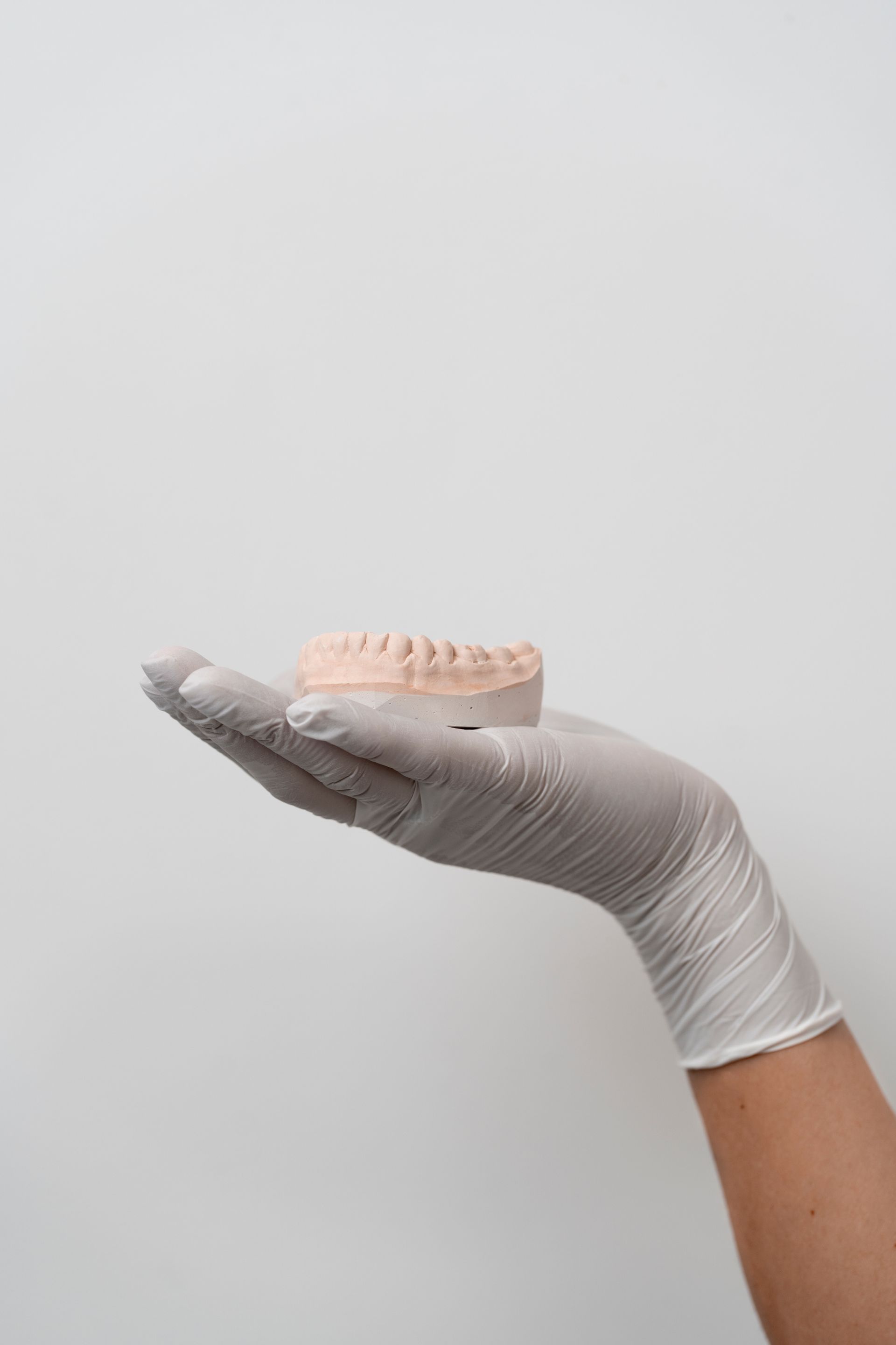 Mano enguantada sosteniendo una impresión dental de los dientes superiores, sobre un fondo blanco.