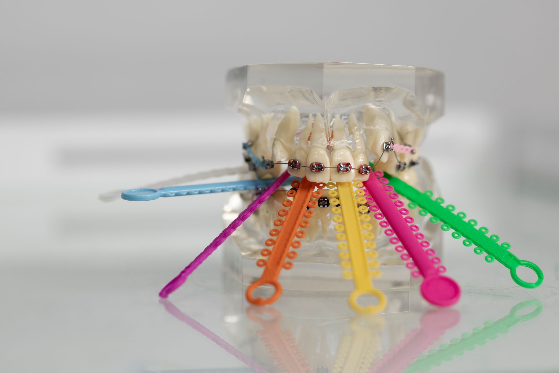 Modelo de dientes con elásticos de ortodoncia de colores fijados a brackets.
