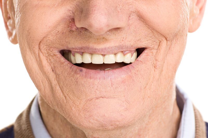 Close-up on cheerful senior man smiling — Denture Services in Newcastle, NSW