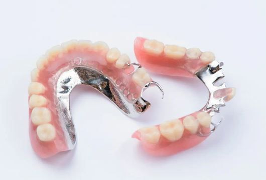 Denture with Metal Clasp — Emergency Denture Repairs in Newcastle, NSW
