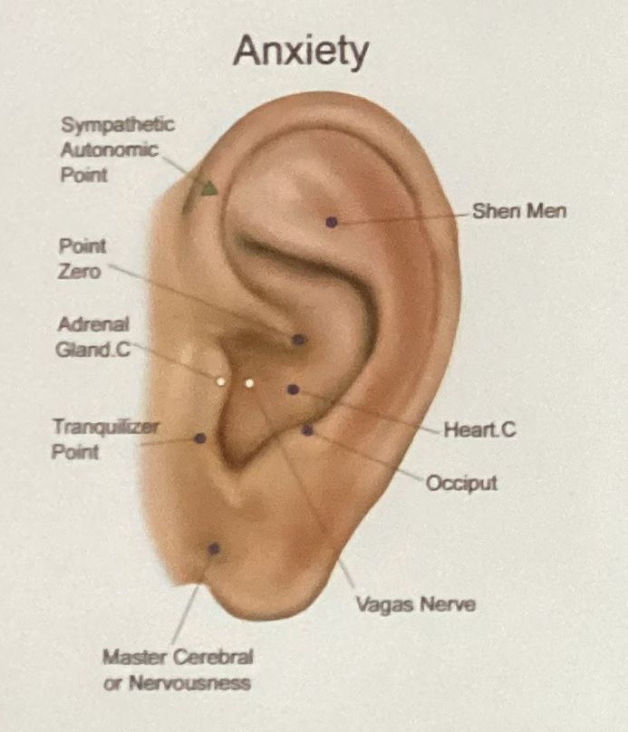 A diagram of an ear with the word anxiety on it