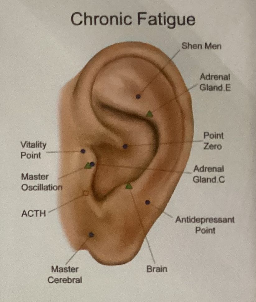 A diagram of a person 's ear showing the points for chronic fatigue