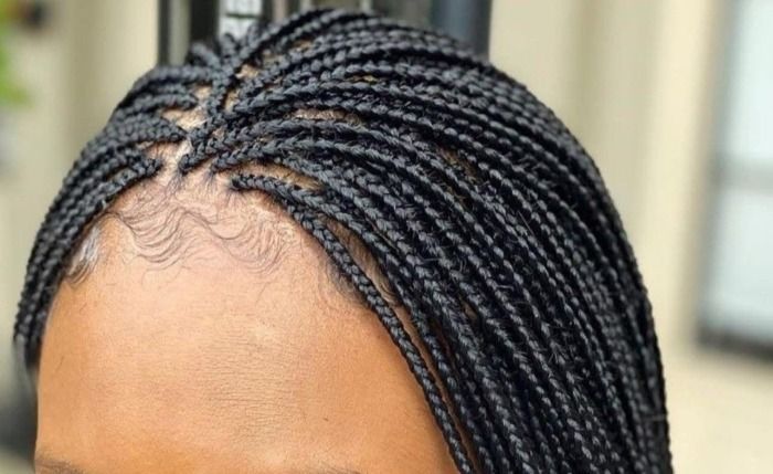Close-up of a person's scalp with neatly braided black box braids, some baby hairs visible.