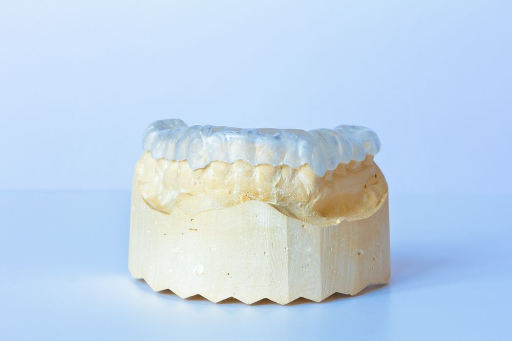 Clear teeth aligner on a plaster dental model against a light blue background. — Trower Dental In Casuarina, NT