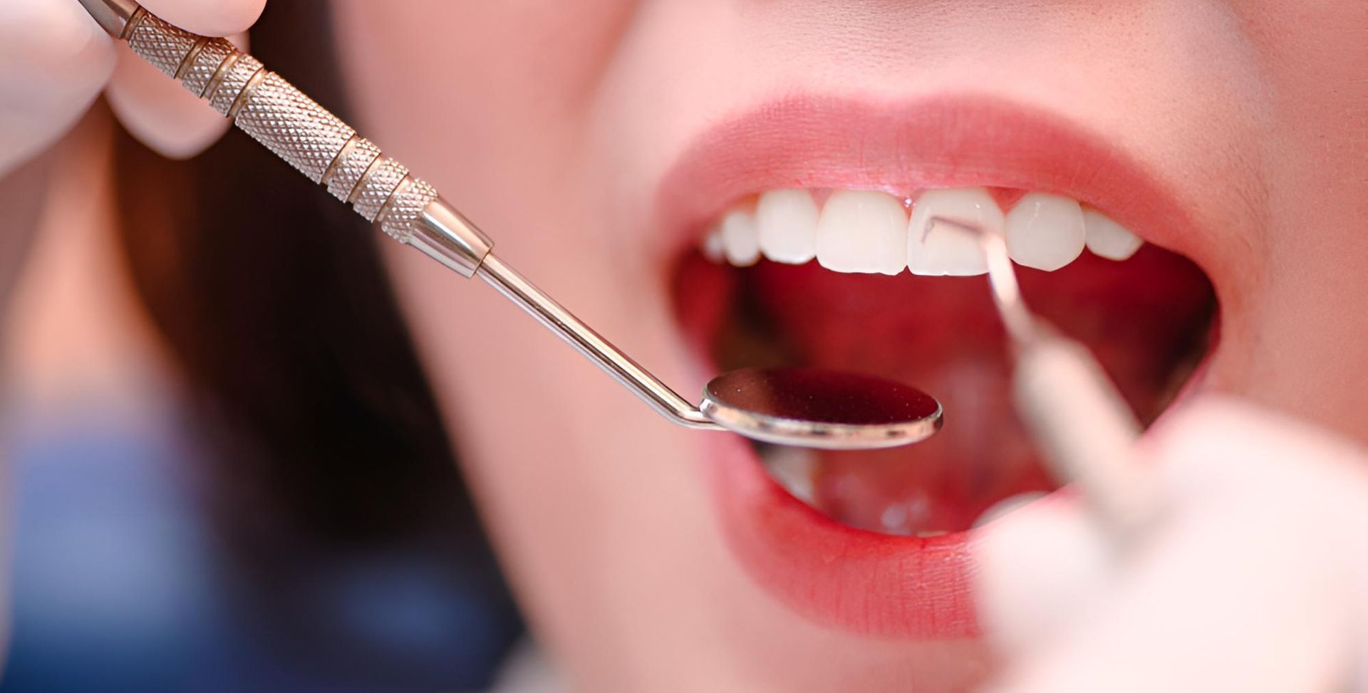 A Woman is Getting Her Teeth Examined by a Dentist — Trower Dental In Casuarina, NT
