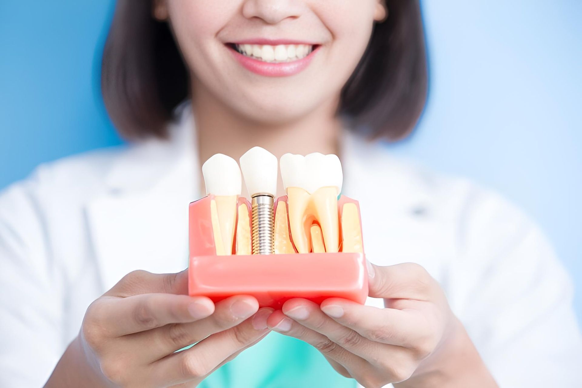 A Woman is Holding a Model of Dental Implants in Her Hands — Trower Dental In Casuarina, NT