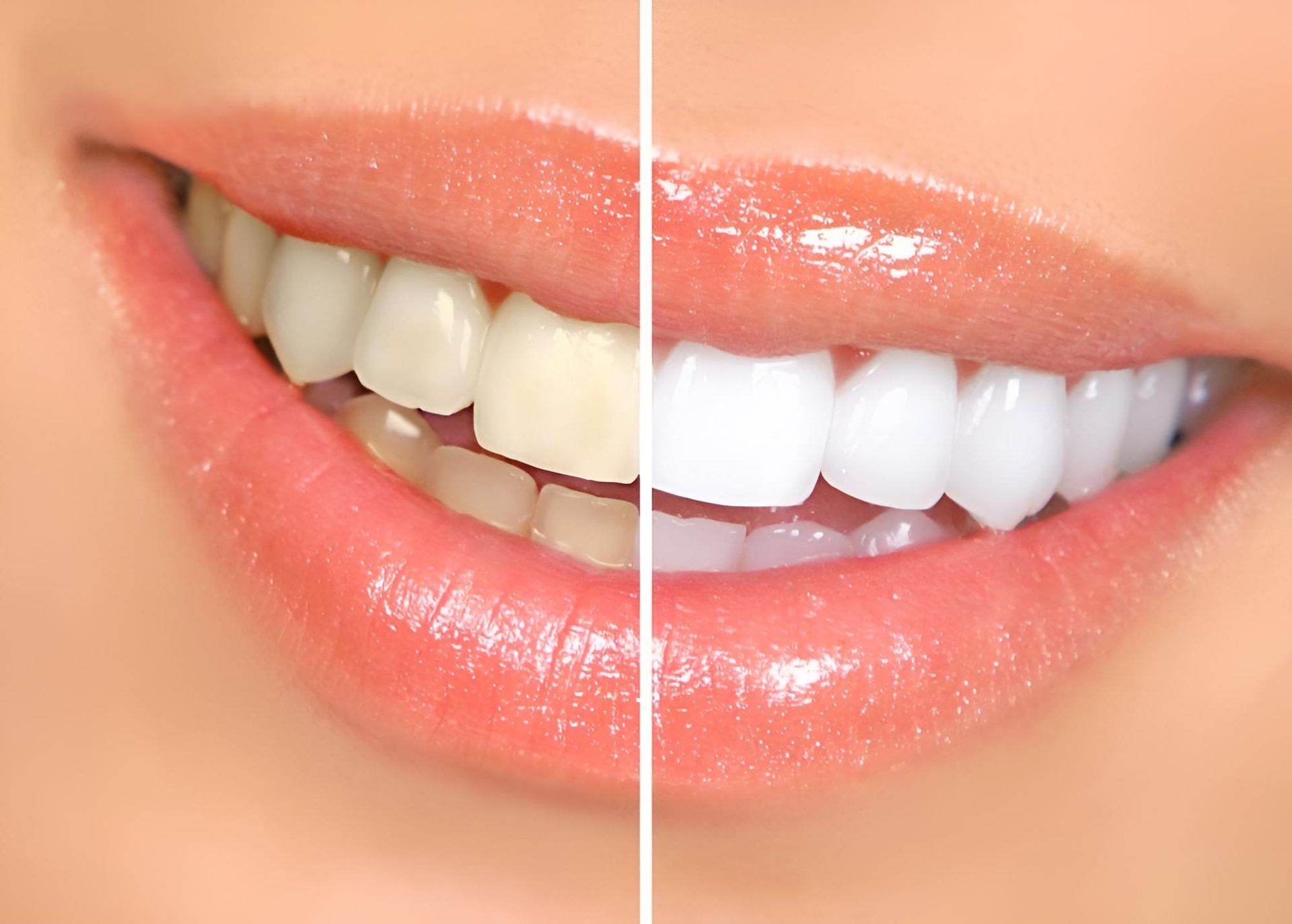 A Before and After Picture of a Woman's Teeth — Trower Dental In Palmerston, NT