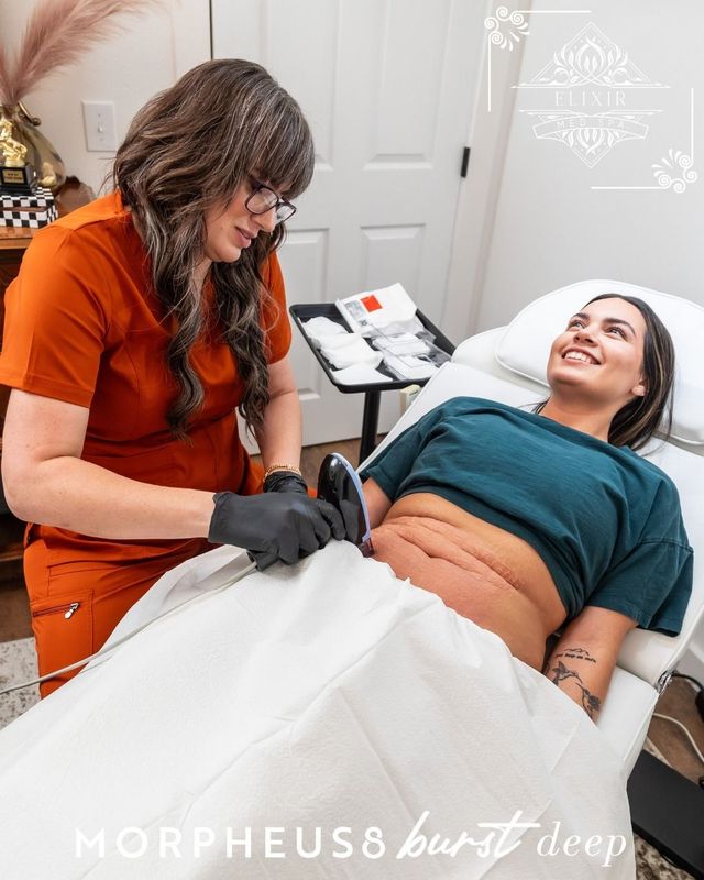 Morpheus8 BurstDeep | Lufkin, TX | Elixir Med Spa LLC