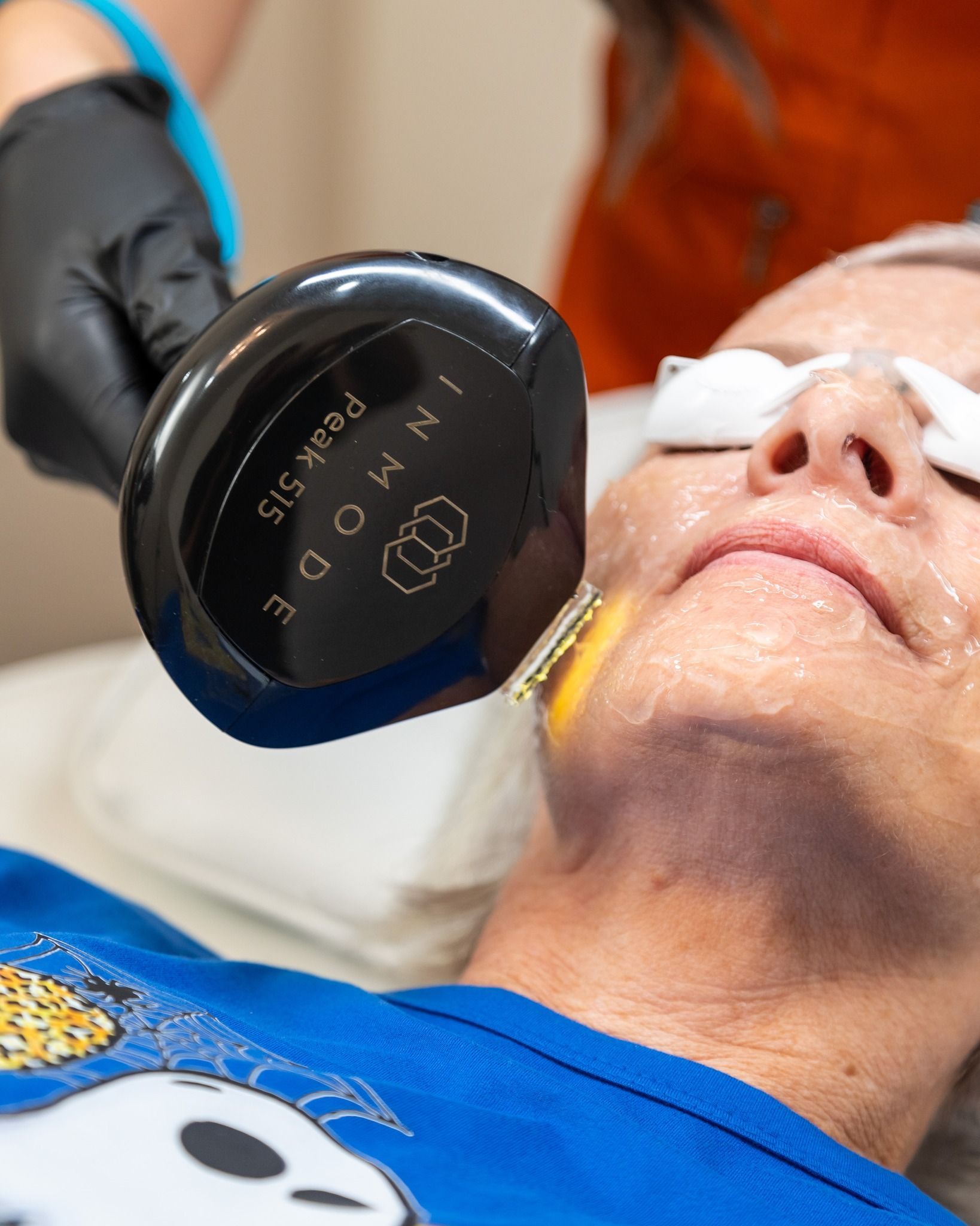 A woman is getting a laser treatment on her face.
