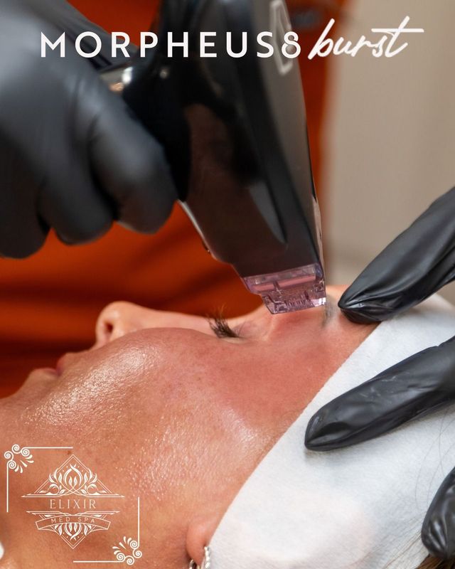 Morpheus8 Burst | Lufkin, Texas | Elixir Med Spa LLC
