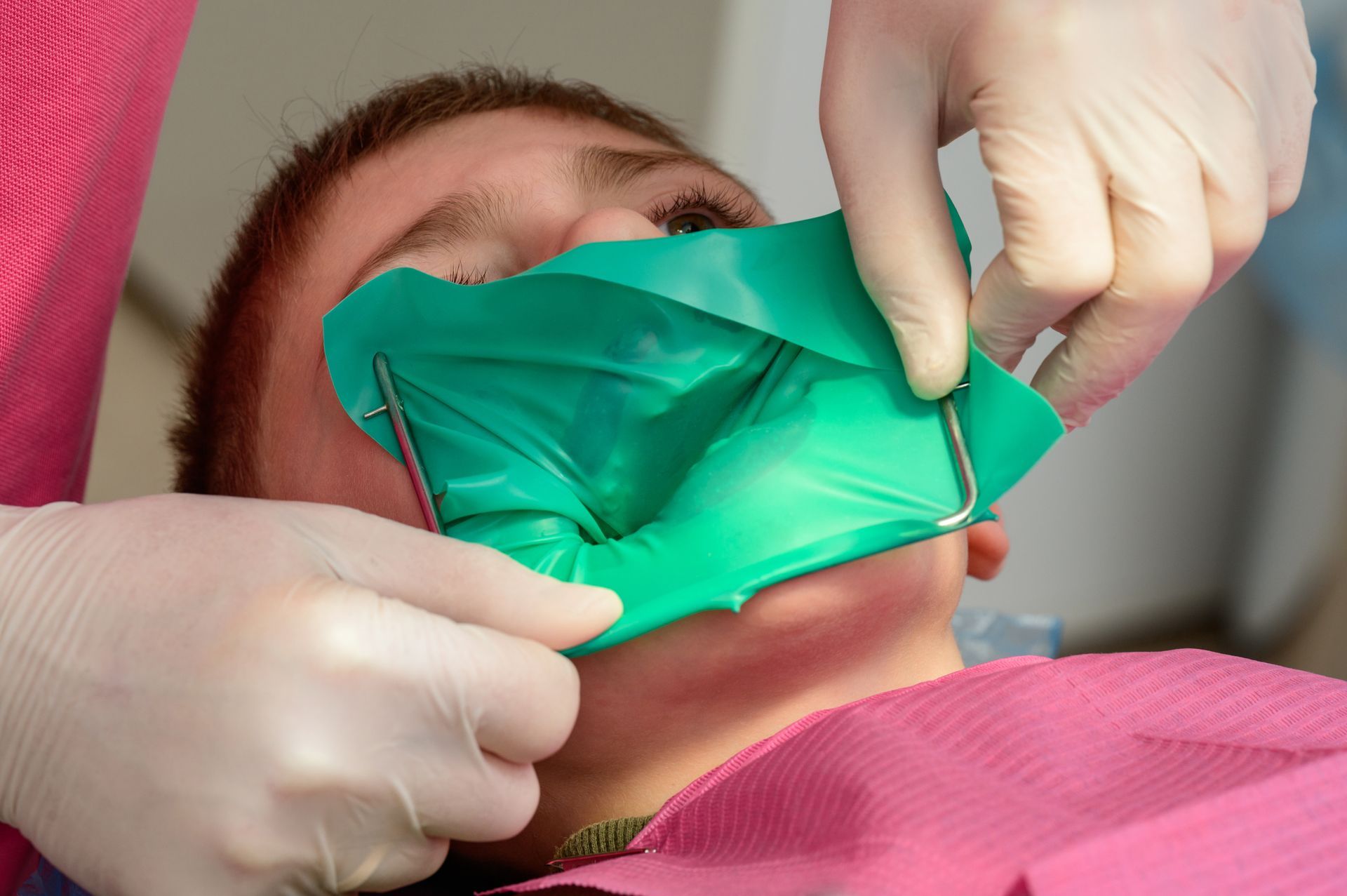 Dentist placing a green dental dam on a patient's mouth for a procedure.