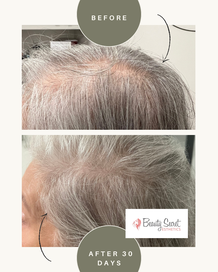 A before and after photo of a woman 's hair growth.