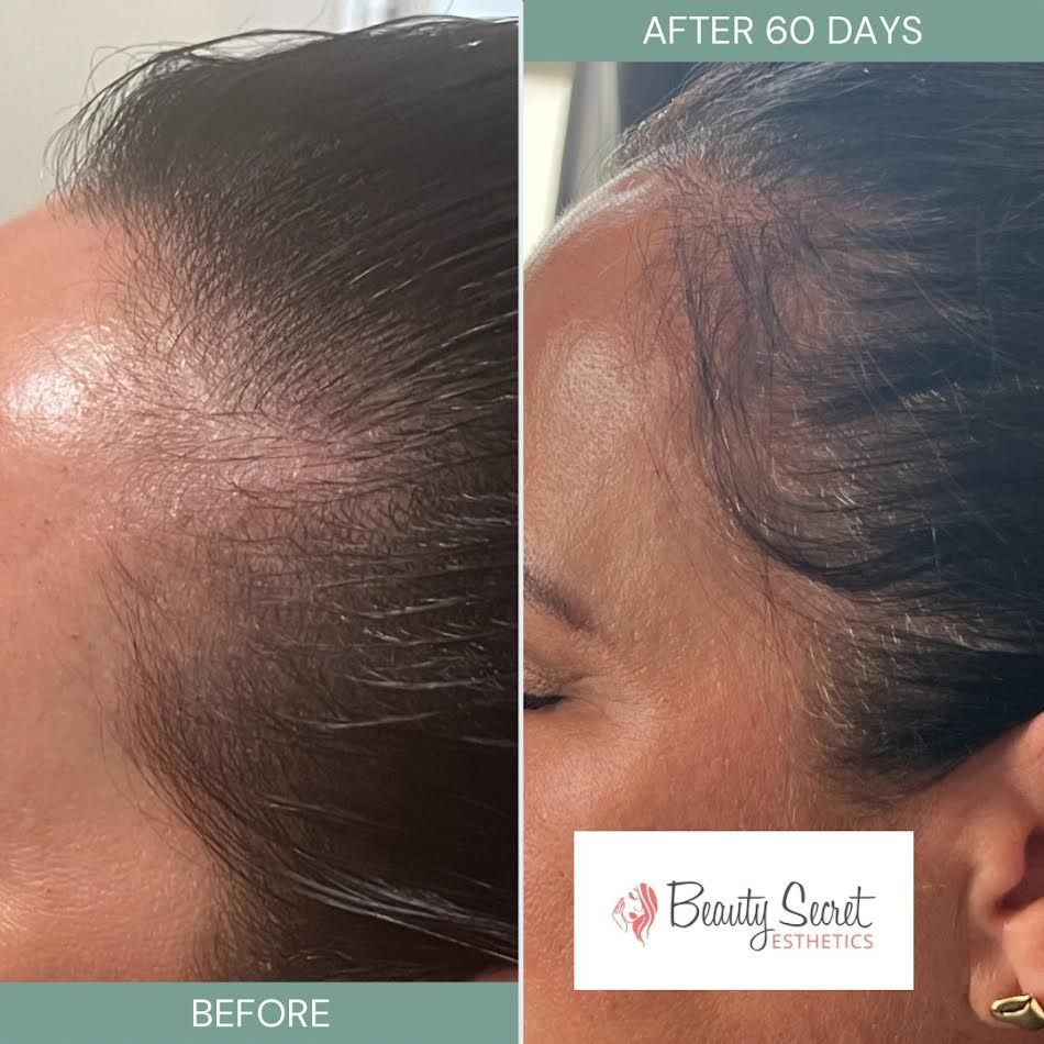 A before and after photo of a woman 's hair growth.