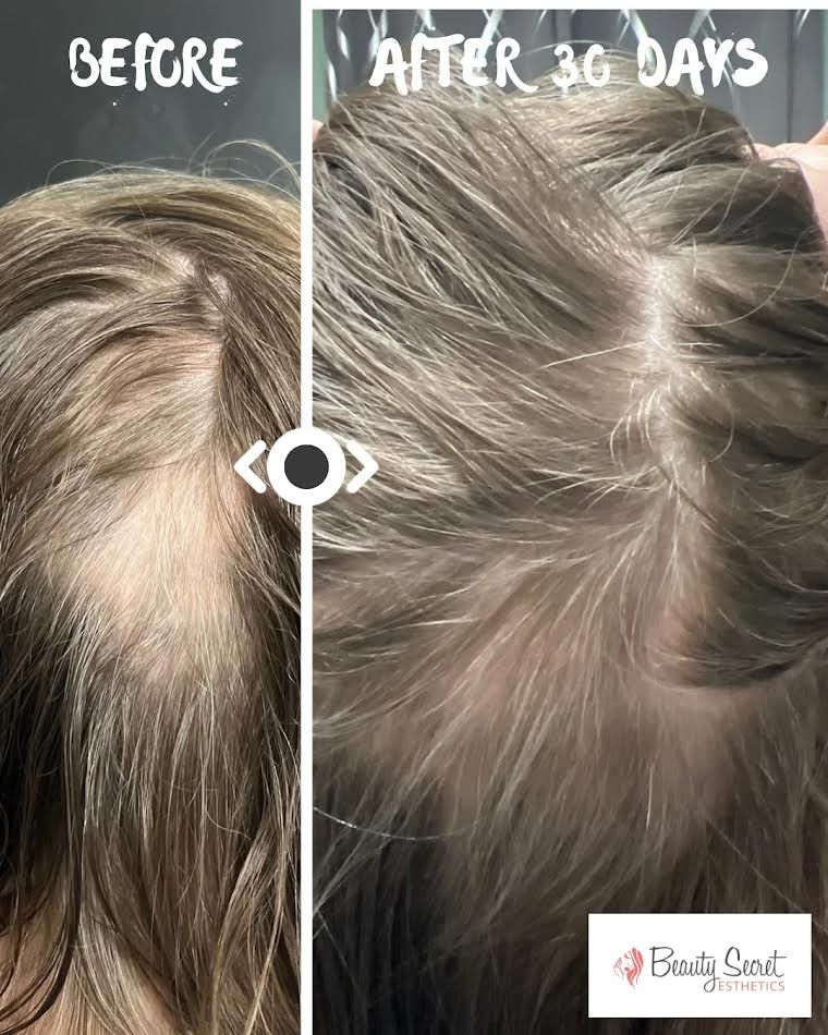 A before and after picture of a person 's hair