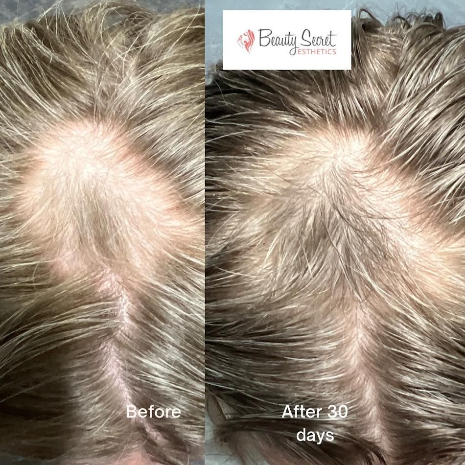 A before and after photo of a person 's hair.