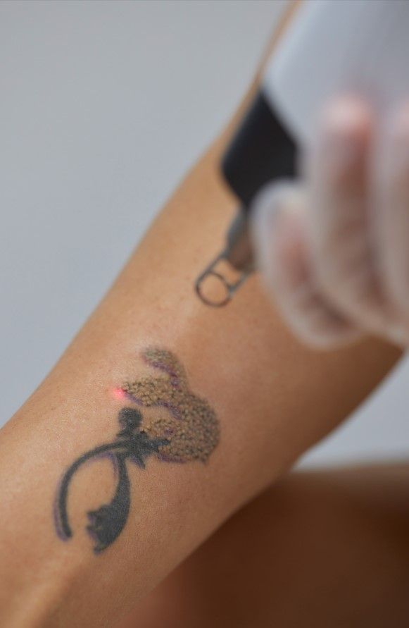 Forearm with a small dragon tattoo and a gloved hand holding a tattoo machine nearby