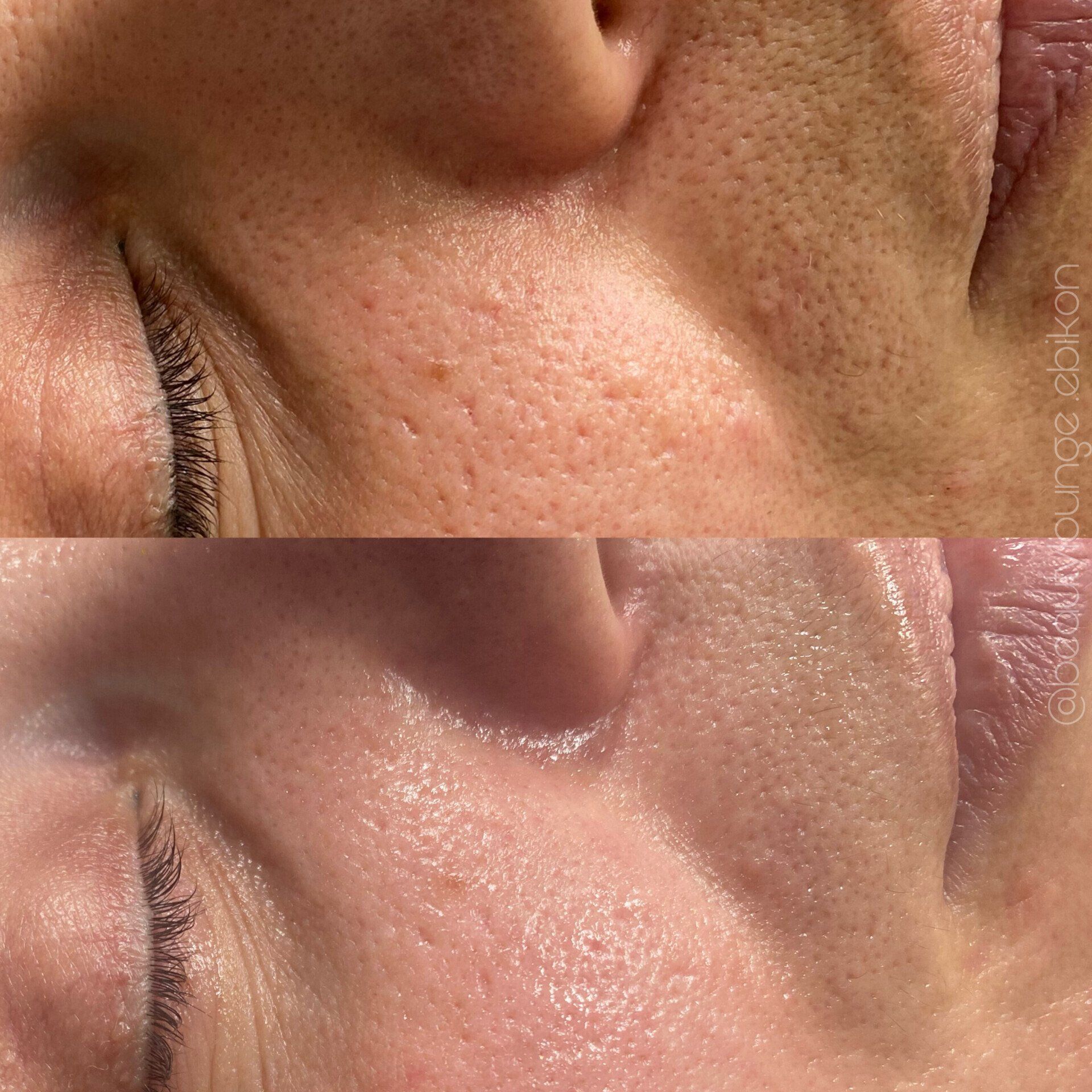 Ein Vorher-Nachher-Foto vom Gesicht einer Frau