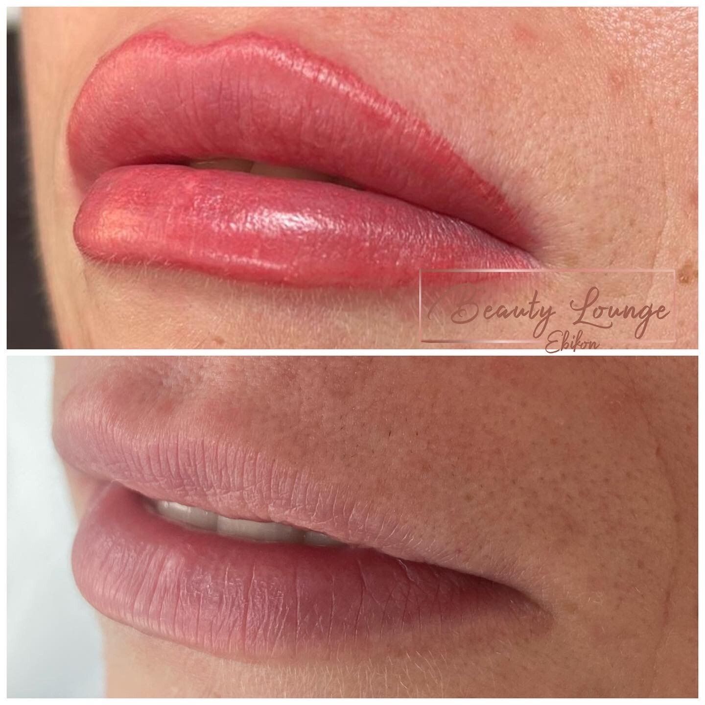 Ein Vorher-Nachher-Foto der Lippen einer Frau.