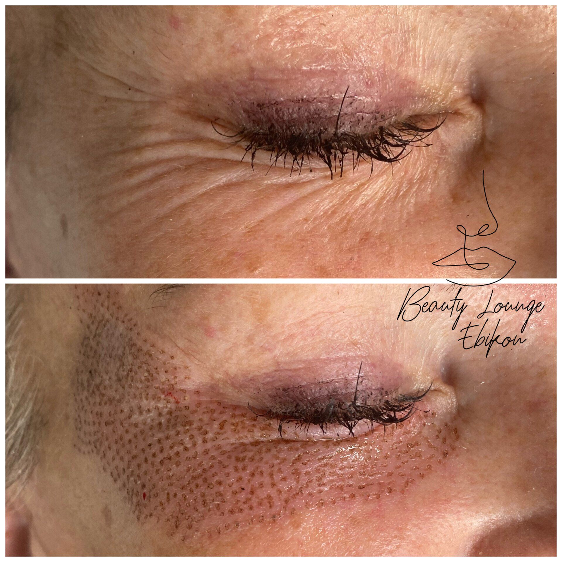 Ein Vorher-Nachher-Foto des Auges einer Frau