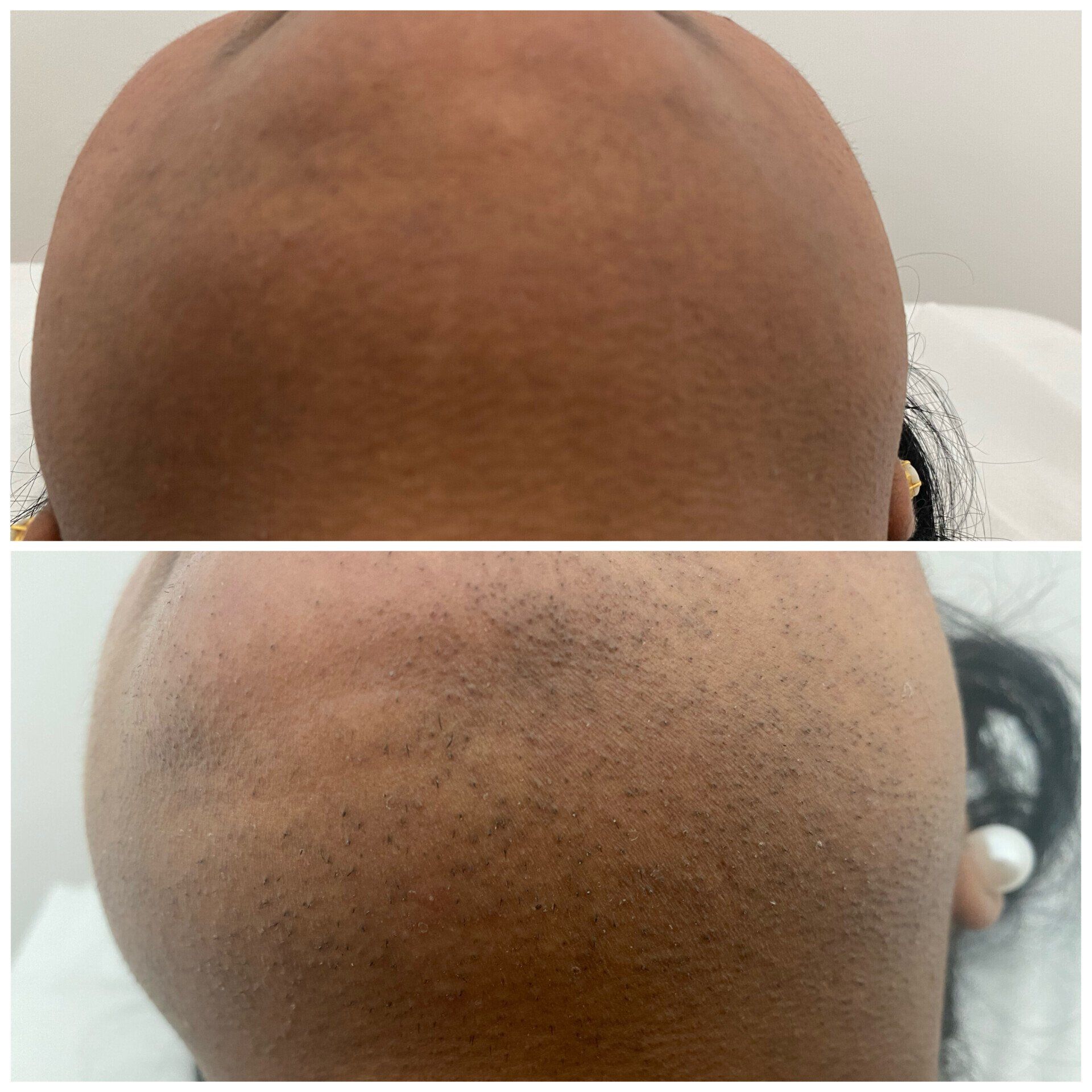 Ein Vorher-Nachher-Bild des Kopfes einer Person