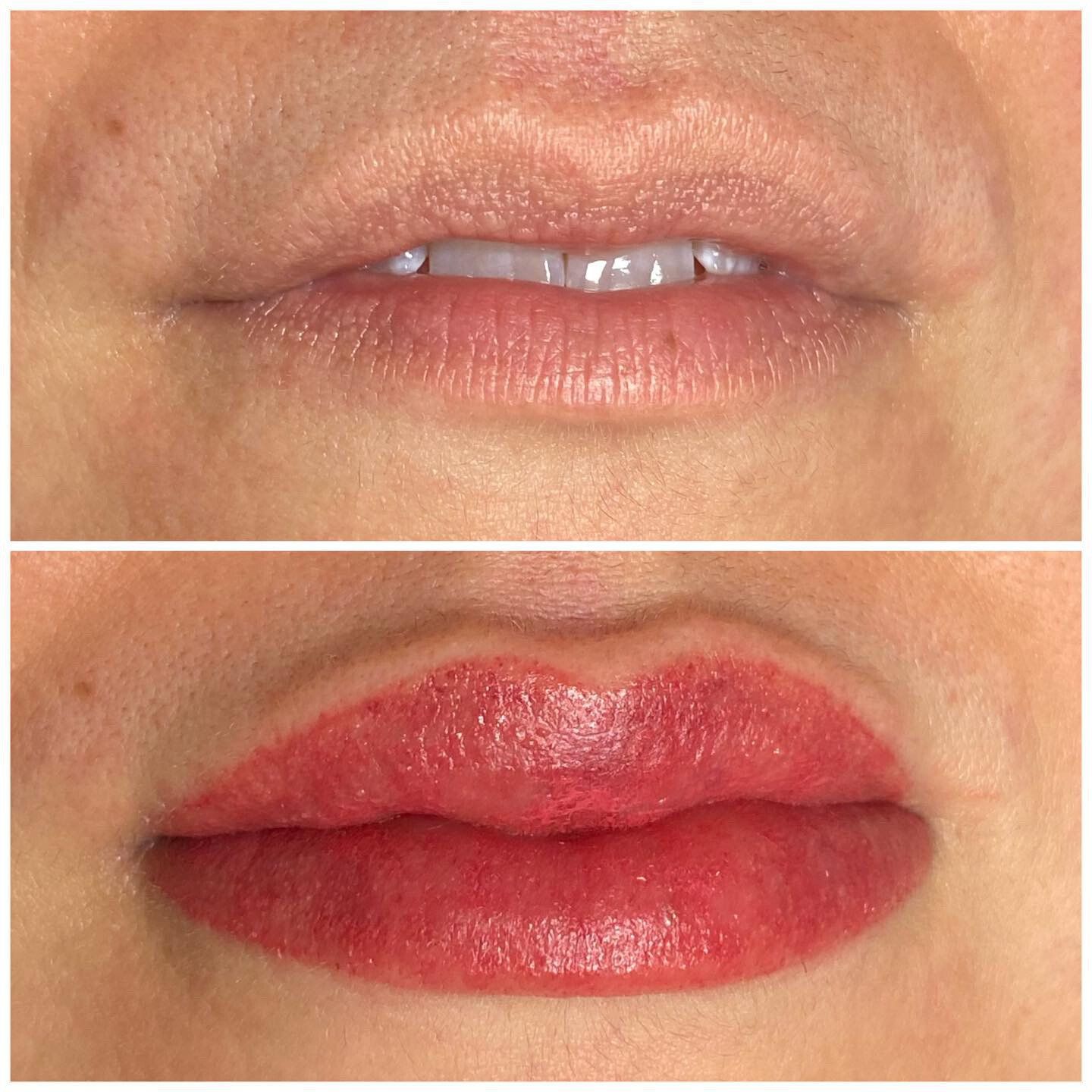 Ein Vorher-Nachher-Foto der Lippen einer Frau.