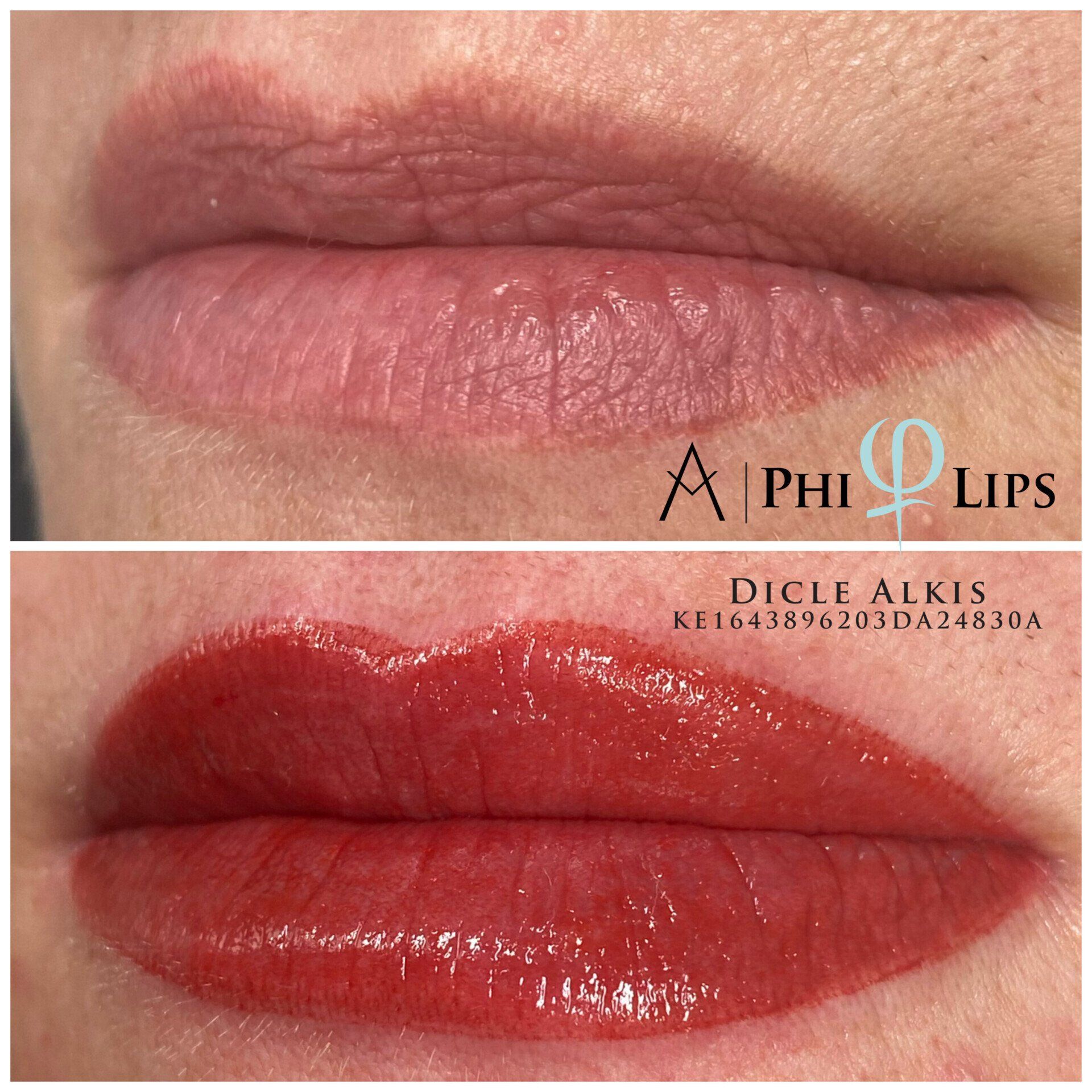 Ein Vorher-Nachher-Foto der Lippen einer Frau mit einem Phillips-Logo