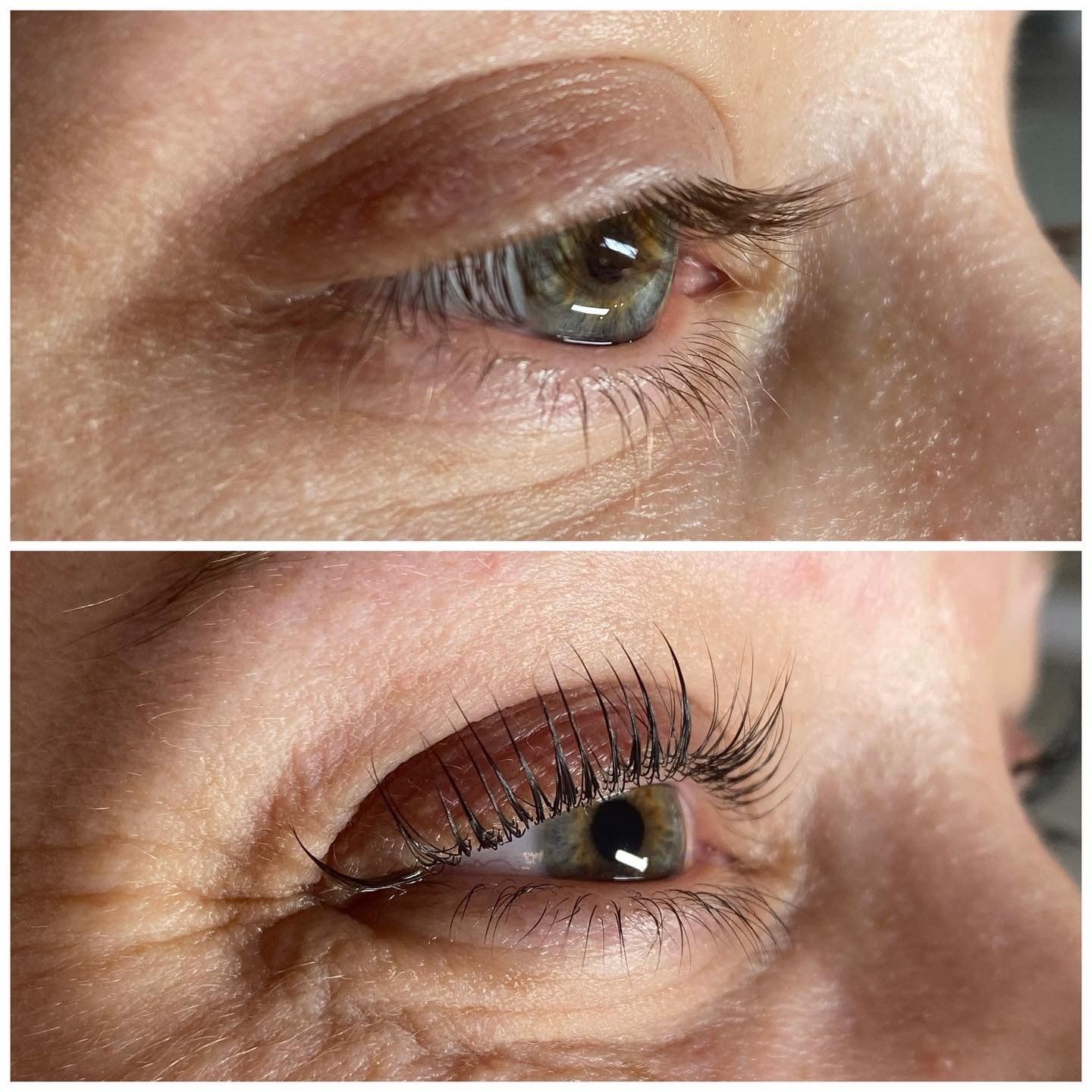 Ein Vorher-Nachher-Foto des Auges einer Frau