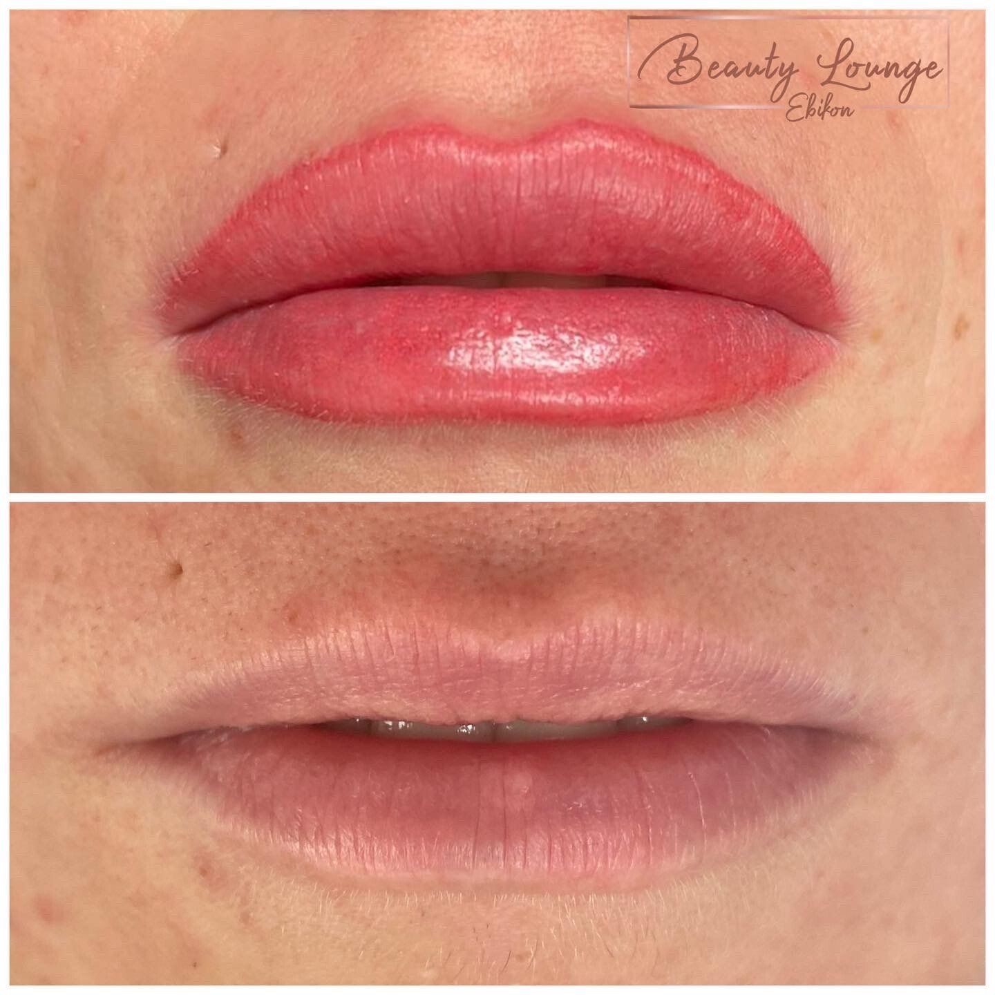 Ein Vorher-Nachher-Foto der Lippen einer Frau.