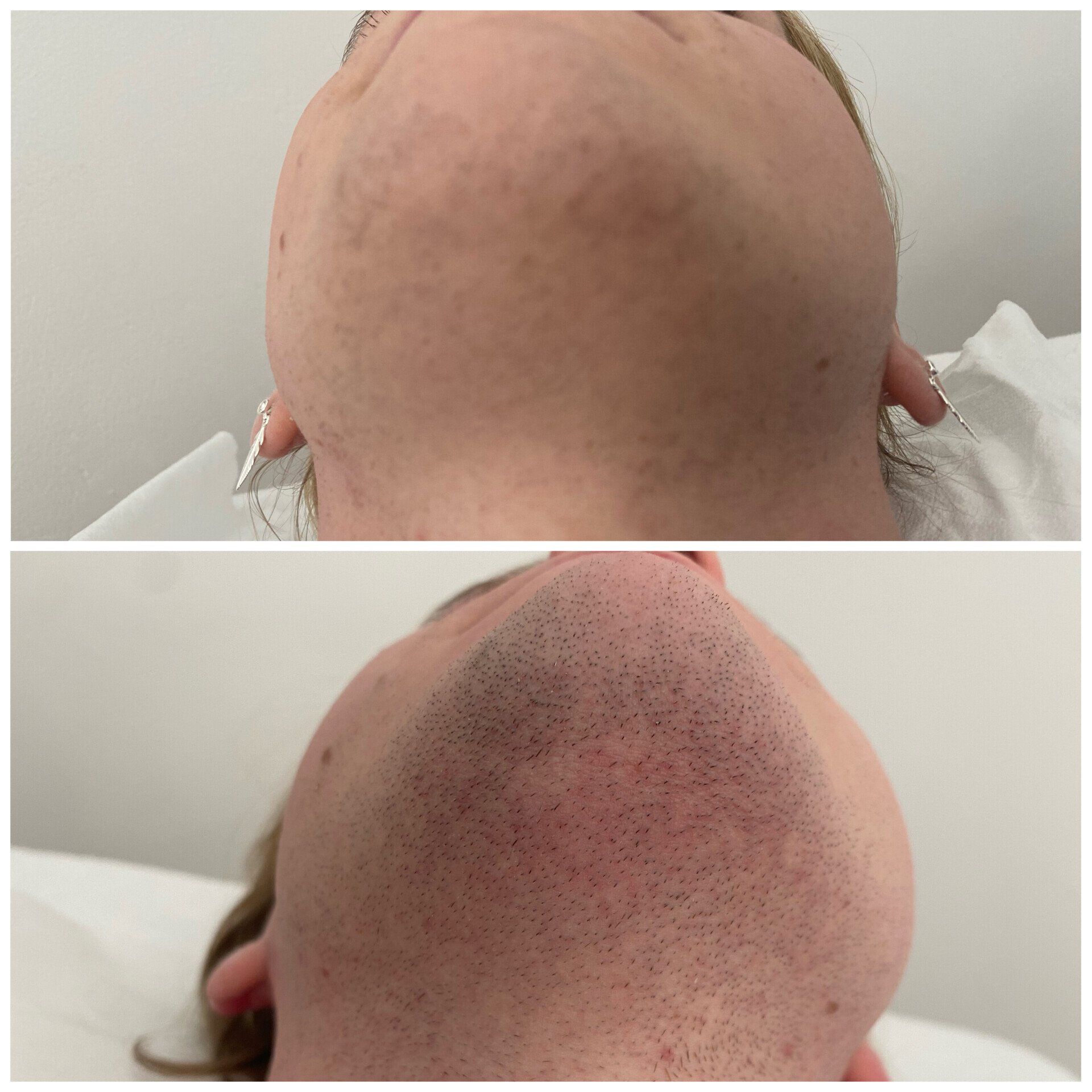 Ein Vorher-Nachher-Foto von Kopf und Hals eines Mannes