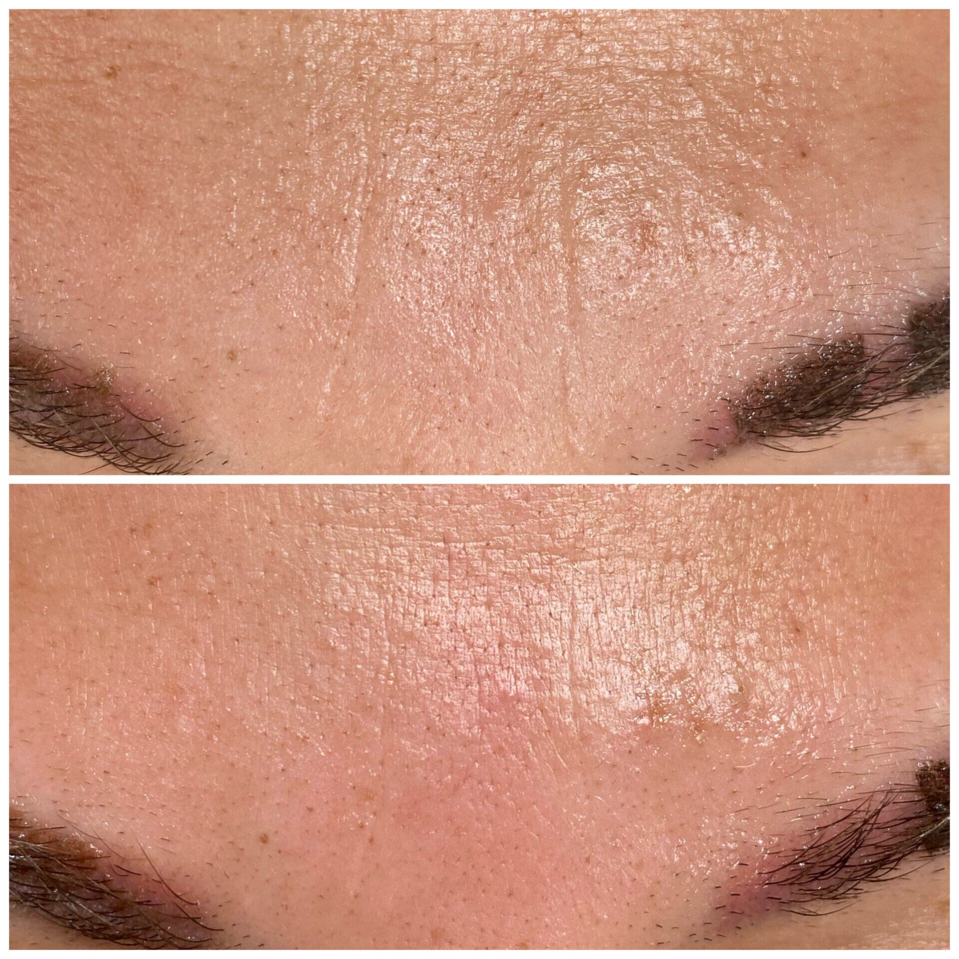 Ein Vorher-Nachher-Bild des Gesichts einer Frau