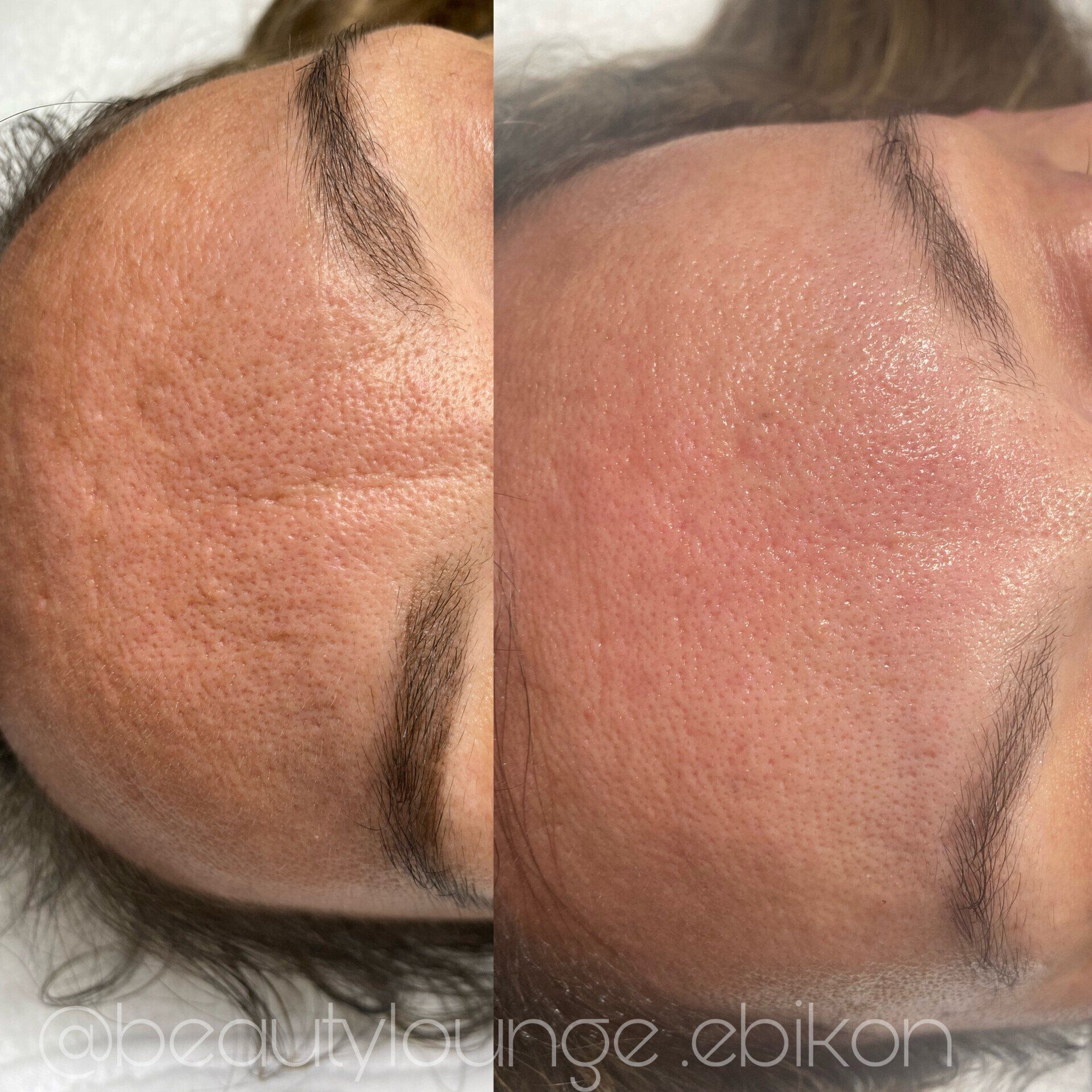 Ein Vorher-Nachher-Foto vom Gesicht einer Frau