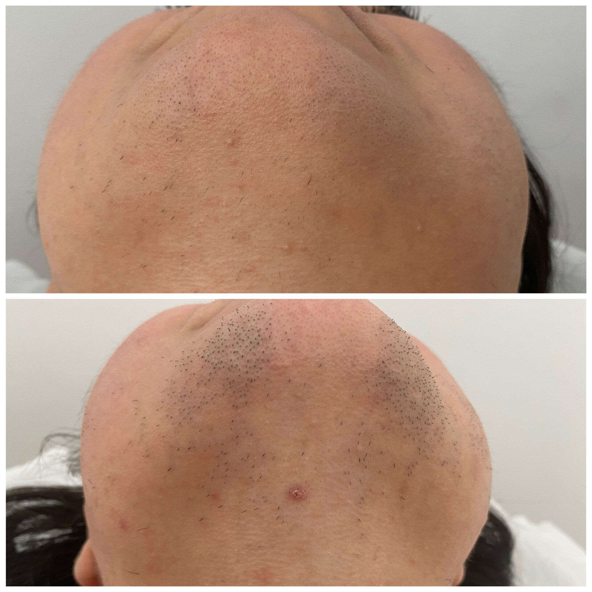 Ein Vorher-Nachher-Bild eines Männerkopfes