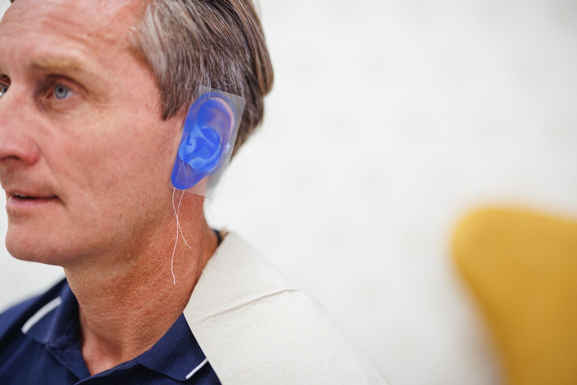 Man wearing a blue ear mold device with wires near his neck. White backdrop.