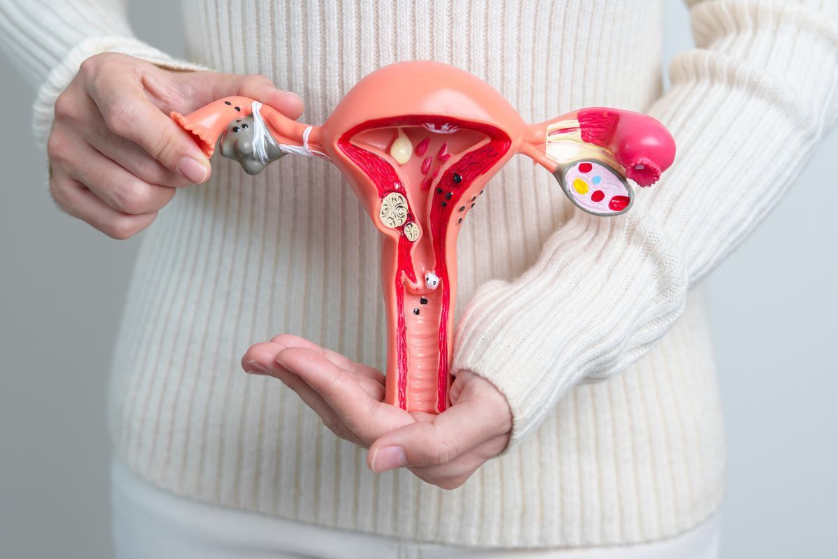 Abscesso tubo-ovariano: saiba como identificar e tratar