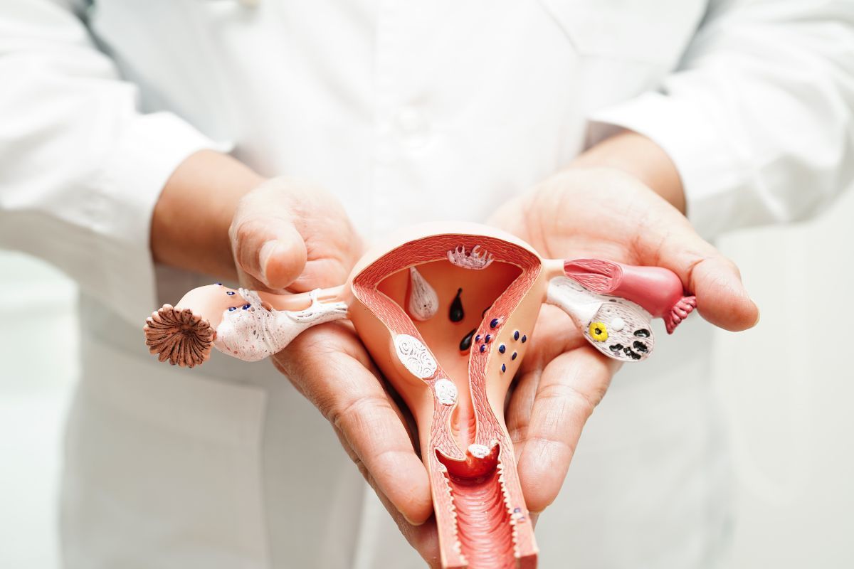 Extração de tubas uterinas: quando é necessária?