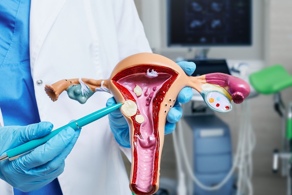 sindrome-de-congestao-pelvica-causas-dra-juliana-ribeiro-ginecologista-sao-paulo
