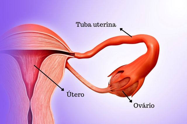 Obstrução das tubas uterinas: o que pode causar e como tratar? » Dr João  Dias