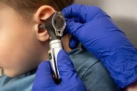 Illustration of earwax buildup showing symptoms such as tinnitus, dizziness, and muffled hearing in the ear canal.