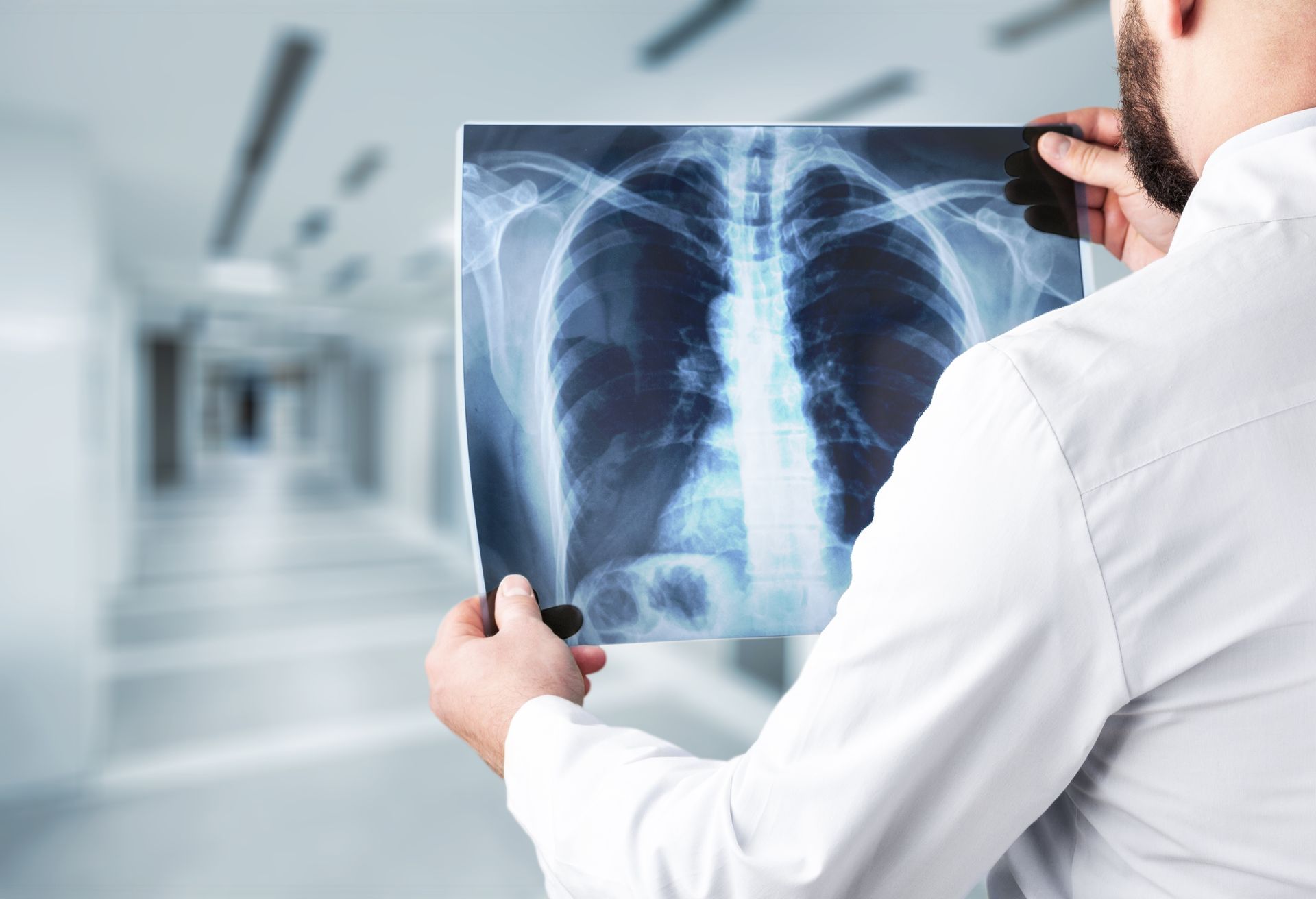 A doctor is holding an x-ray of a person 's lungs.