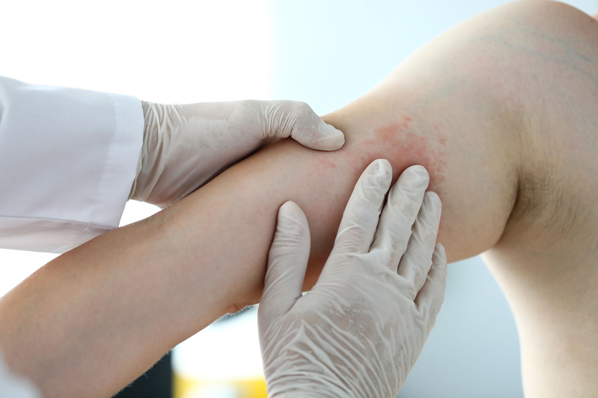 A doctor is examining a patient 's leg with gloves on.