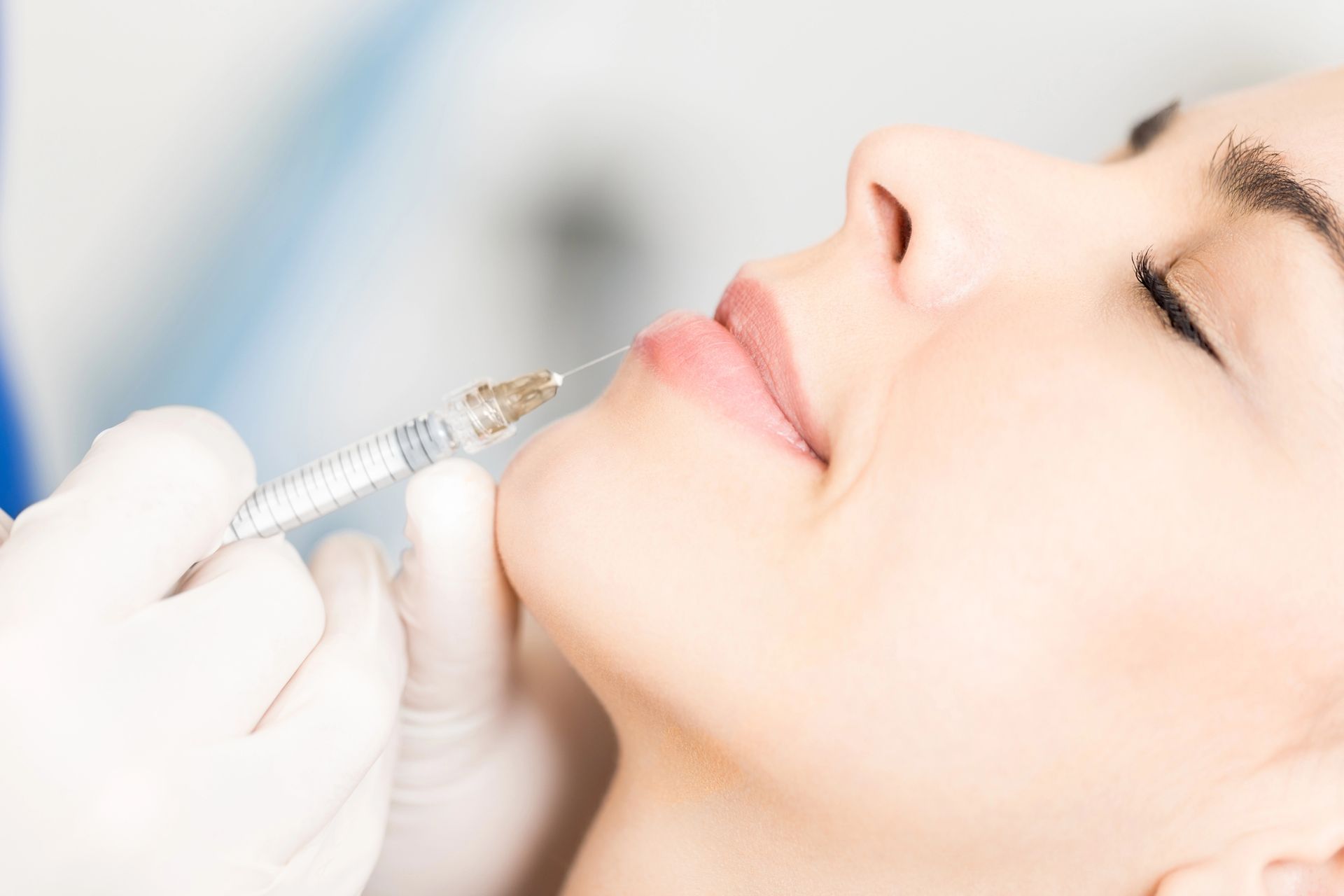 Iniezione cosmetica al mento di una donna con una siringa, eseguita da una mano guantata.