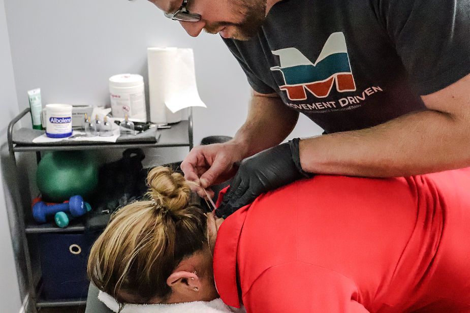 A man is giving a woman an acupuncture treatment.