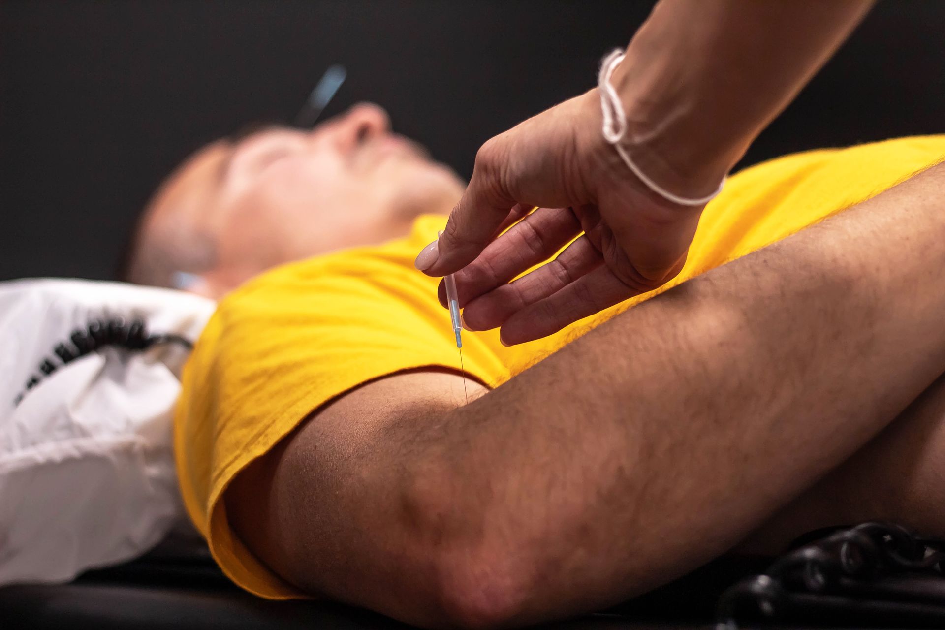 A person is getting acupuncture on their shoulder