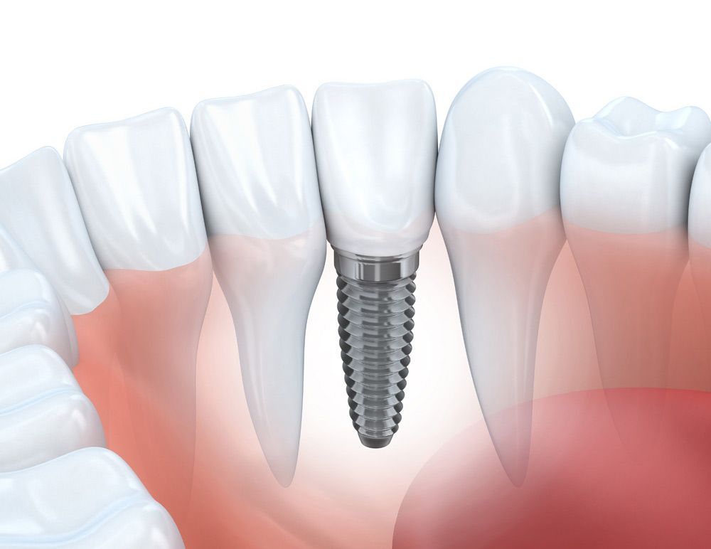 chirurgia maxillo facciale