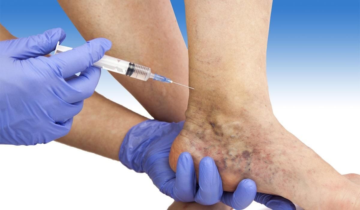 DR. RUBÉN MONTOYA VELÁZQUEZ