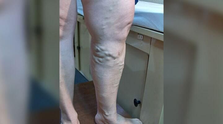 DR. RUBÉN MONTOYA VELÁZQUEZ